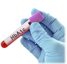 Imagen tubo HbA1c